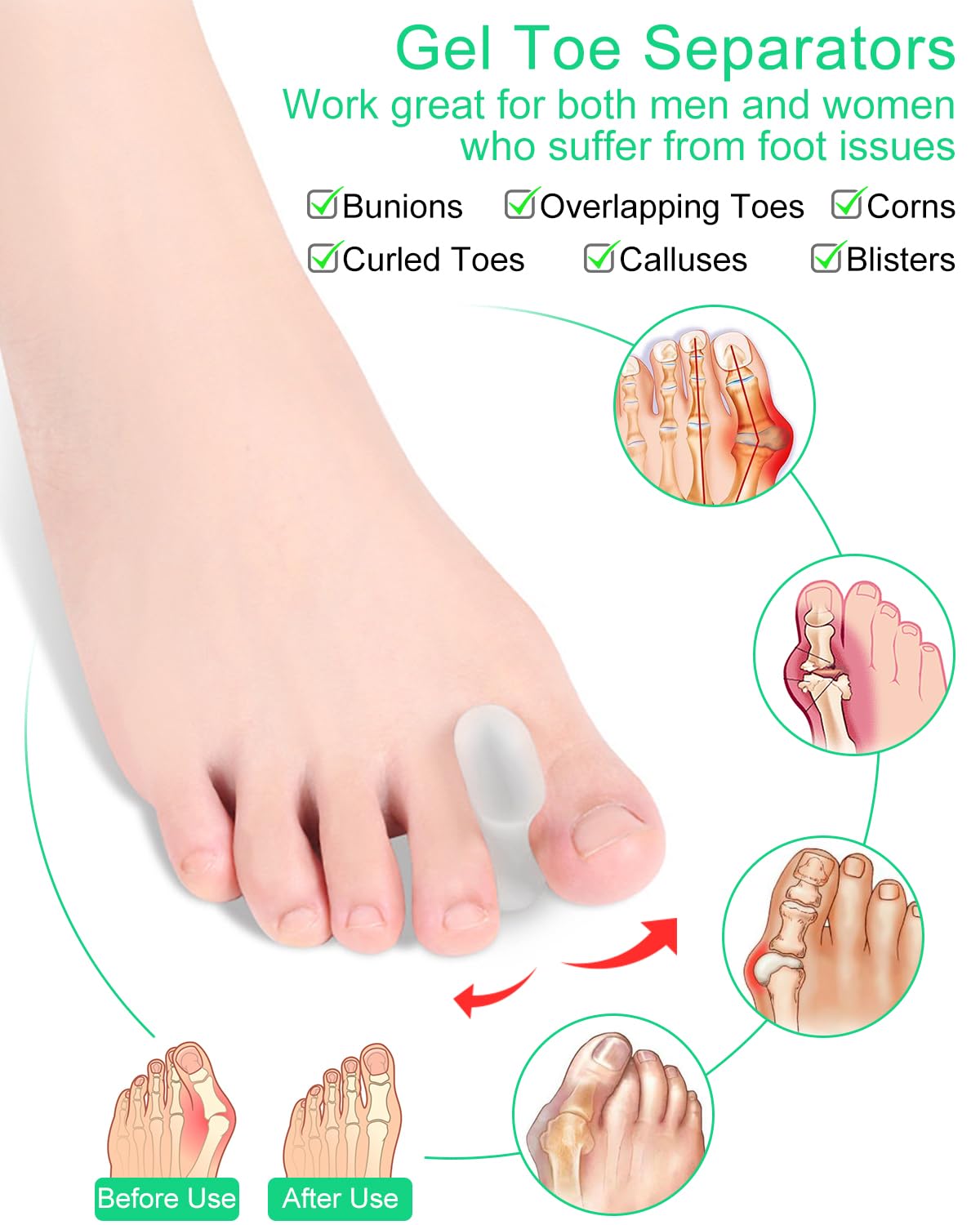 PGRODE 12 Pack Gel Toe Separators Silicone Toe Spacers for Women Men Bunion Corrector Toe Pain Relief, Toe Alignment, Soft Toe Spacer for Crooked Toes, Overlapping Toes, Hammertoe Correction (Small)