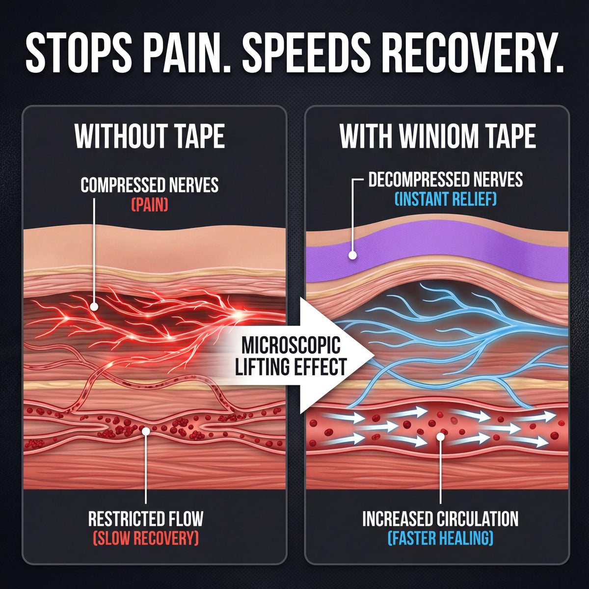 WINIOM Kinesiology Tape - Waterproof Athletic Sports Tape for Knee, Shoulder, Arm & Back Support | 3-5 Day Adhesion, Hypoallergenic & Latex-Free + Taping Guide (Uncut, 2" x16.4ft Roll, Indigo Purple)